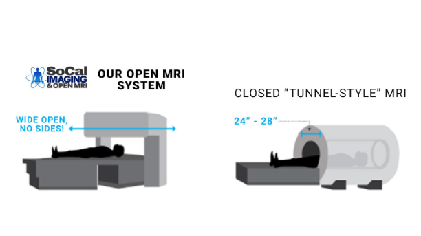 closed mri vs open mri